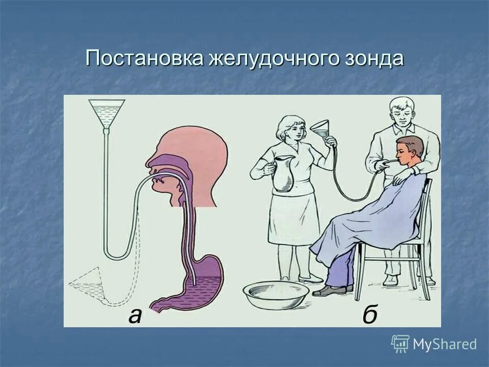 Дуоденальному зондированию где сделать. Дуоденальному зондированию где сделать