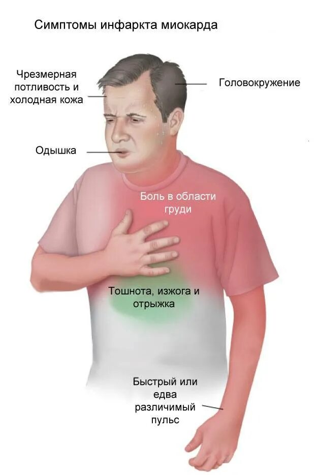 Колит возле сердца