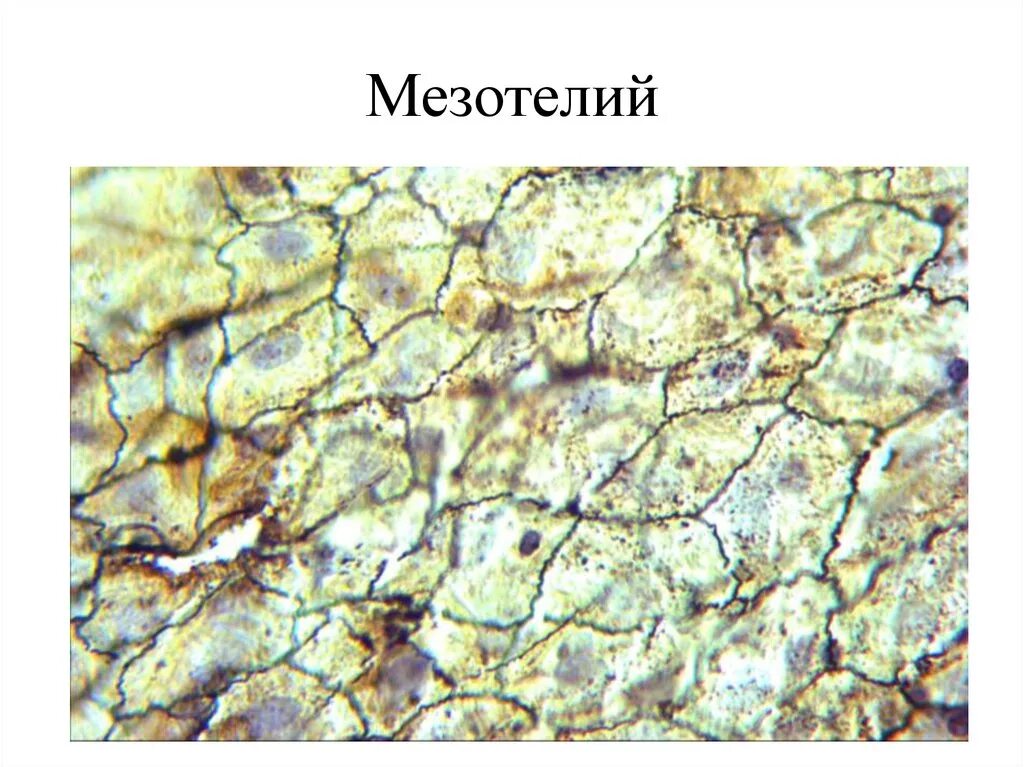 Однослойный мезотелий. Однослойный плоский эпителий мезотелий. Однослойный плоский эпителий микроскоп. Однослойный плоский эпителий гистология. Однослойный плоский эпителий мезотелий сальника.