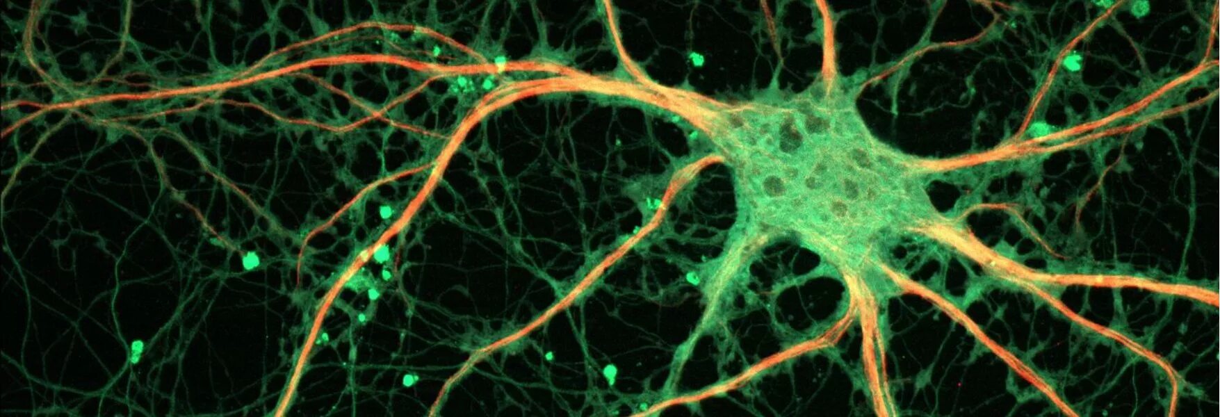 Нервная клетка. Нервная ткань. Клетки мозга под микроскопом. Нервные клетки человека.