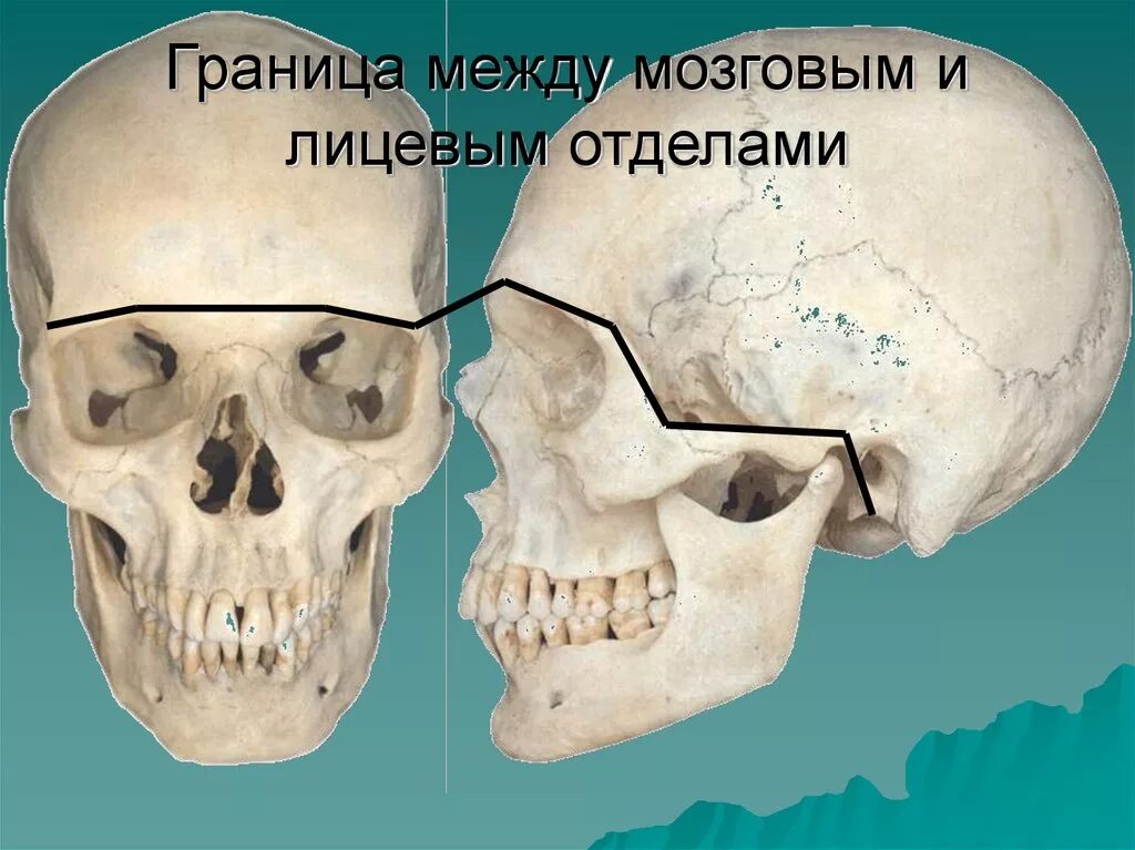 Граница мозгового и лицевого отделов черепа. Граница между лицевым и мозговым черепом. Череп анатомия мозговой и лицевой. Лицевая кость. Термин череп