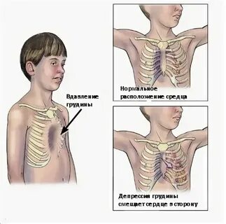 У новорожденного ребенка грудная клетка