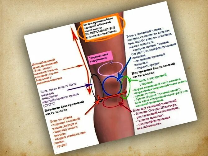 Боль кв колени при ходьбе. Балитколено при ходьбе. Болит колено с внутренней стороны. Болит колено при ходьбе.