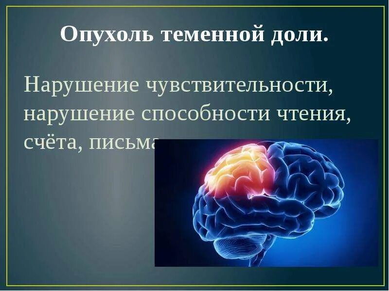 Опухоли теменной. Опухоли теменной доли симптомы. Опухоль теменной доли головного мозга. Опухоль левой теменной доли головного мозга. Симптомы поражения теменной доли головного мозга.