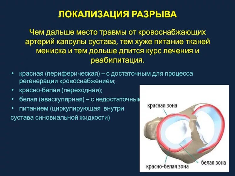 Повреждение суставной капсулы. Разрыв суставной капсулы в позвоночнике. Капсульное повреждение сустава. Суставная капсула разрыв.