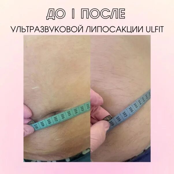 Ким Ту Ман, пластический хирург - 23 отзыва Красноярск - ПроДокторов