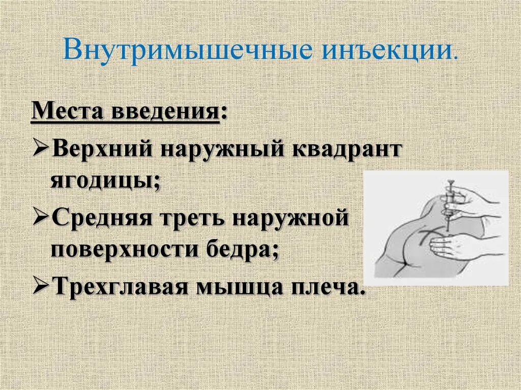 Назначение инъекций. Внутримышечная инъекция. Внутримышечно и ньекция. Места введения инъекций. Внутримышечное Введение.