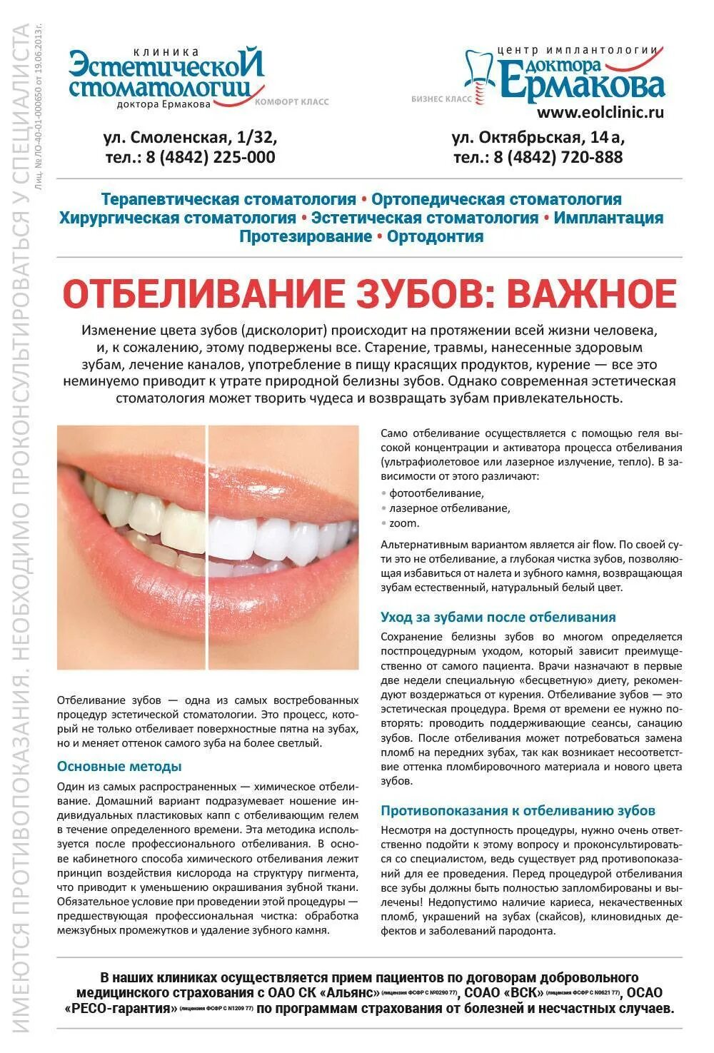 Сколько можно отбелить зубы. Сколько можно отбелить зубы