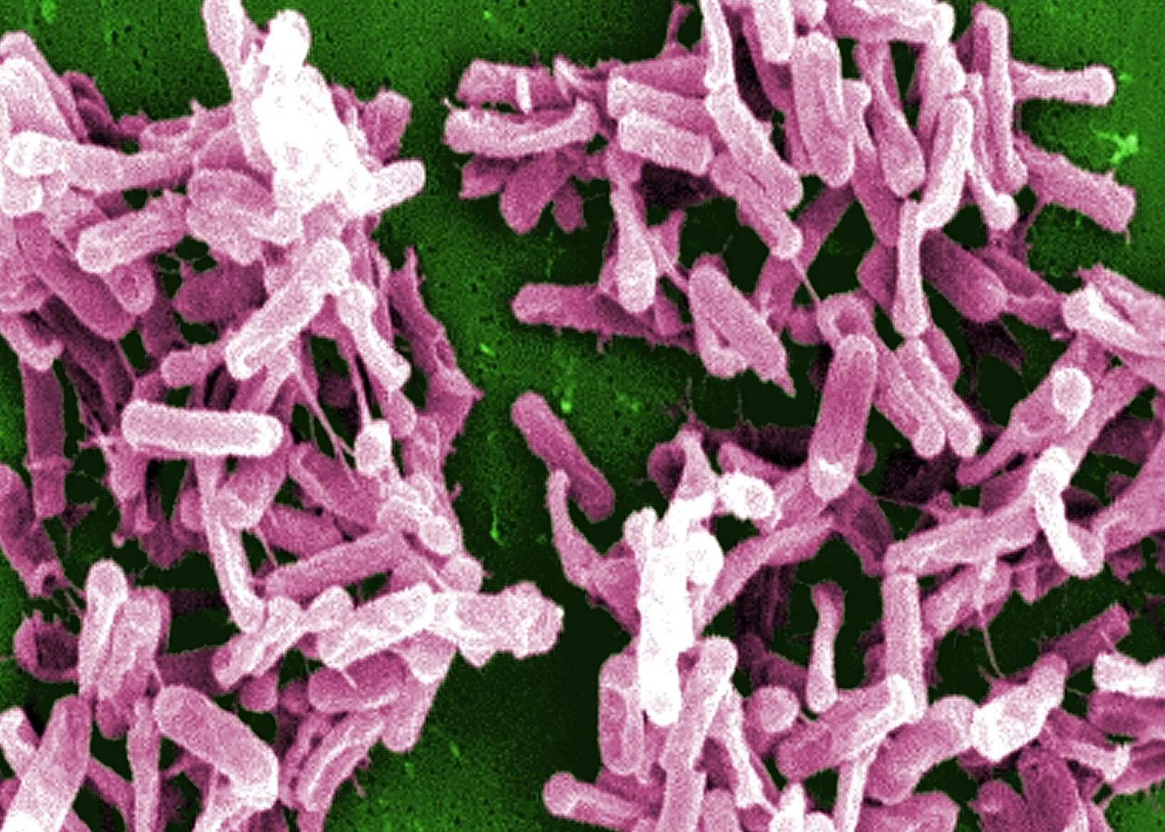 Clostridium spp. Клостридии микробиология. Бактерия клостридия. Мезофильные клостридии. Клостридии бактерии.