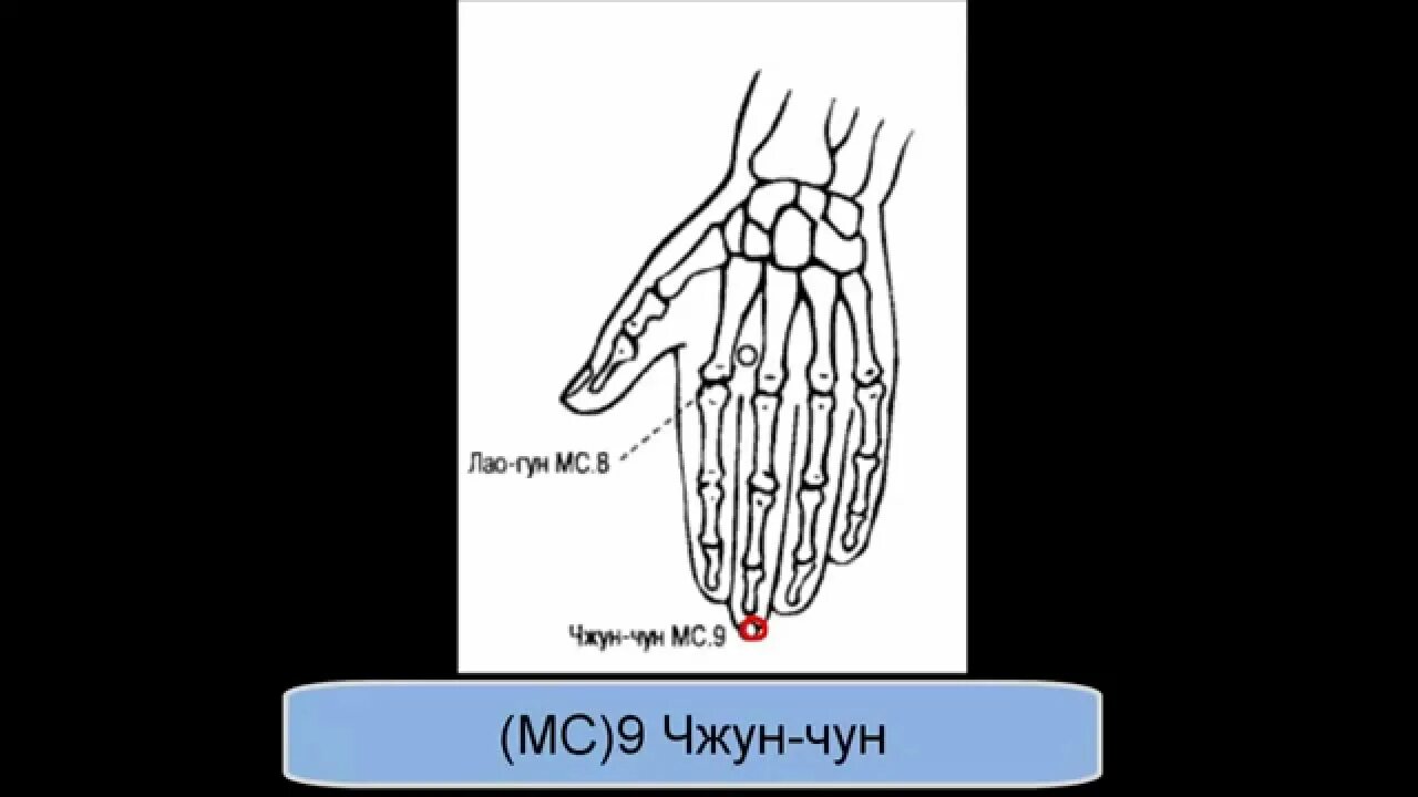 Точка мс 8. МС 9 точка Чжун-Чун. Точка перикарда Чжун Чун. Mc9 точка акупунктуры. Меридиан перикарда MC 9 точка акупунктуры.