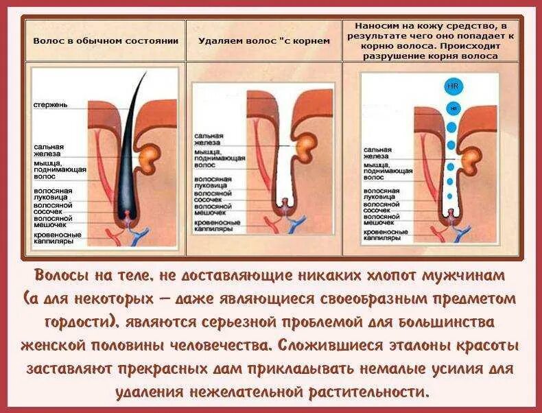 Удаляем нежелательные волосы. Методы избавления от нежелательных волос. Способы избавления от волос. Как избавиться от волос навсегда.