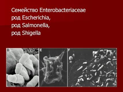 Enterobacteriaceae spp