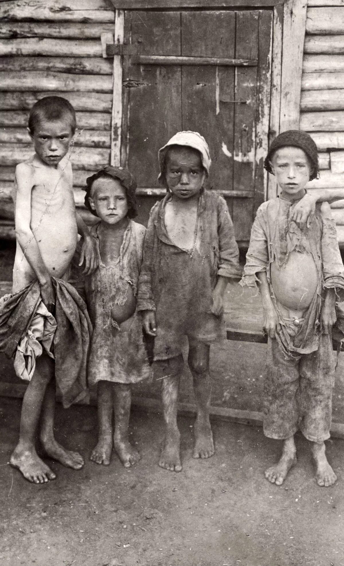 Голод голодных. Дети голод в поволжье 1921-1922.