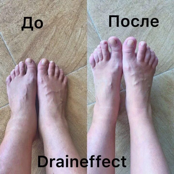 Драйн эффект от отеков. Draineffect до после. результат драйнэффекта. драйн эффект до и после. draineffect до и после фото.