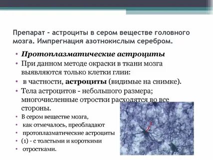 Нейроглия серого вещества