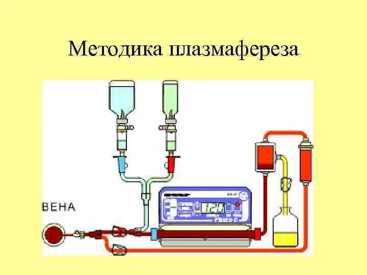 Гемос пф. Схема проведения плазмафереза. гемосорбция и плазмаферез. плазмаферез методика. методика проведения плазмафереза.