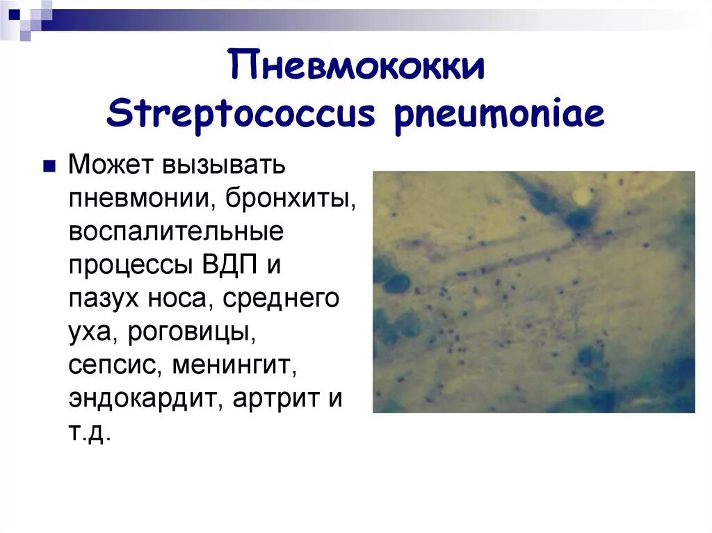 Streptococcus pneumoniae в носу
