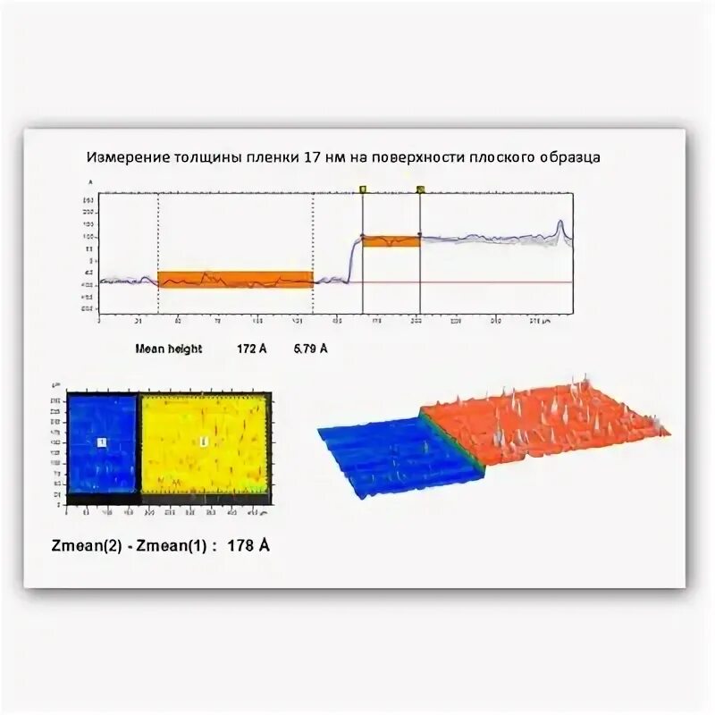 Профилометрия прямой кишки. Профилометрия прямой кишки. Объективизация это в психологии. Профилометрия. Профилометрия уретры.