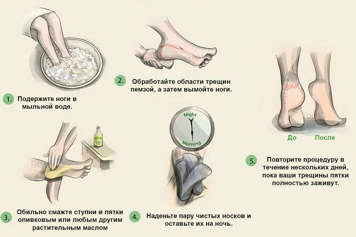 Что делать при трещине