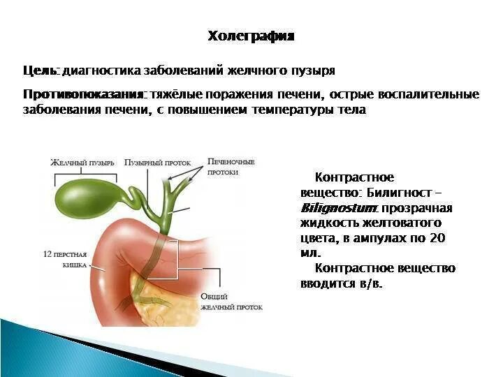 Заболеваний желчевыводящих. Диагностика заболеваний печени и желчевыводящих путей. Диагнозы при заболевании желчного пузыря. Общее название болезней желчного пузыря. Симптомы поражения желчного пузыря и желчевыводящих путей.