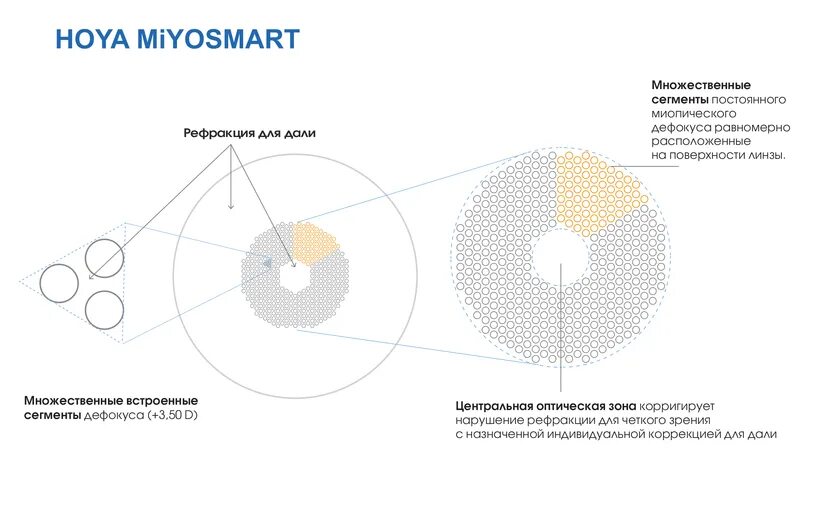 Очковая линза miyosmart. Hoya miyosmart. Диаметр лечебной зоны в линзе miyosmart. Miyosmart линзы. Miyosmart линзы очковые.