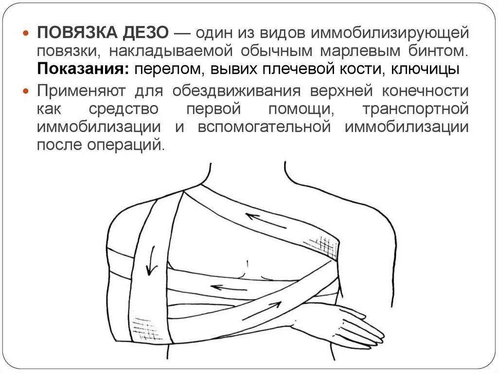 Неподвижные повязки. Иммобилизационная повязка виды. Иммобилизация верхней конечности шиной крамера. Иммобилизирующие повязки. Иммобилизация переломов пмп.