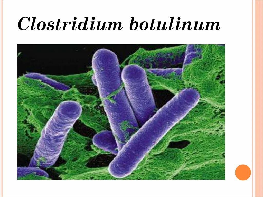 Клостридиум ботулинум. Клостридия ботулинум морфология. Clostridium botulinum микроскопия.