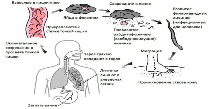 Кишечный цикл. Жизненный цикл угрицы кишечной. цикл развития угрицы кишечной. цикл развития угрицы кишечной схема. угрица кишечная цикл развития схема.