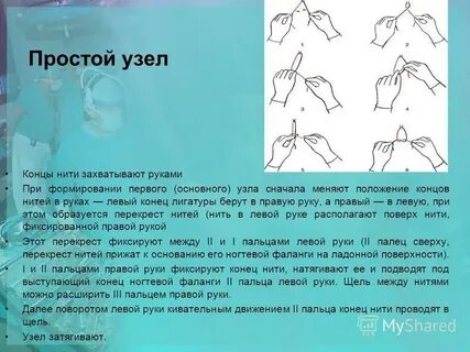 Рассосались узлы