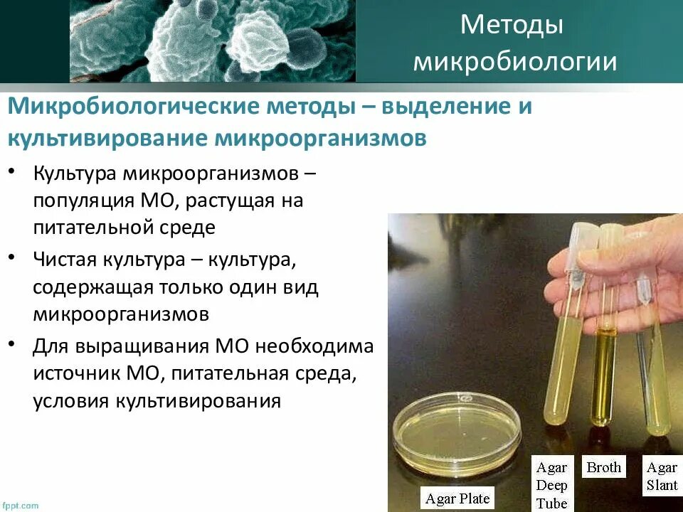 Питательные среды для культивирования бактерий. Методы культивирования микробиология. Микробиологий методы микробиологии. Метод культивирования микробиология.