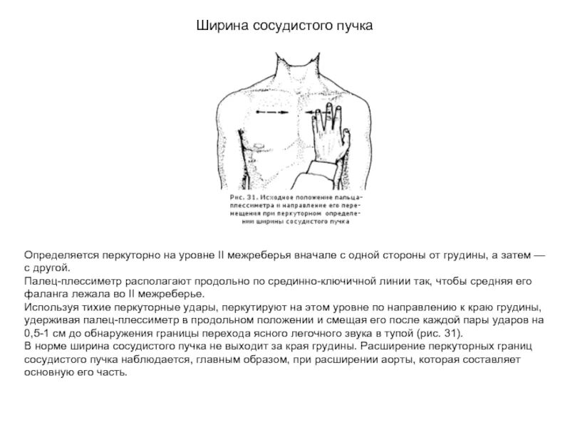 Положение пучков. Методика определения ширины сосудистого пучка. Перкуссия границ сердца и сосудистого пучка в норме. Ширина сосудистого пучка в норме. Границы сосудистого пучка в норме.