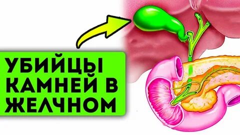 Желчный без операции