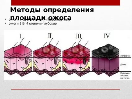Химические поражения кожи