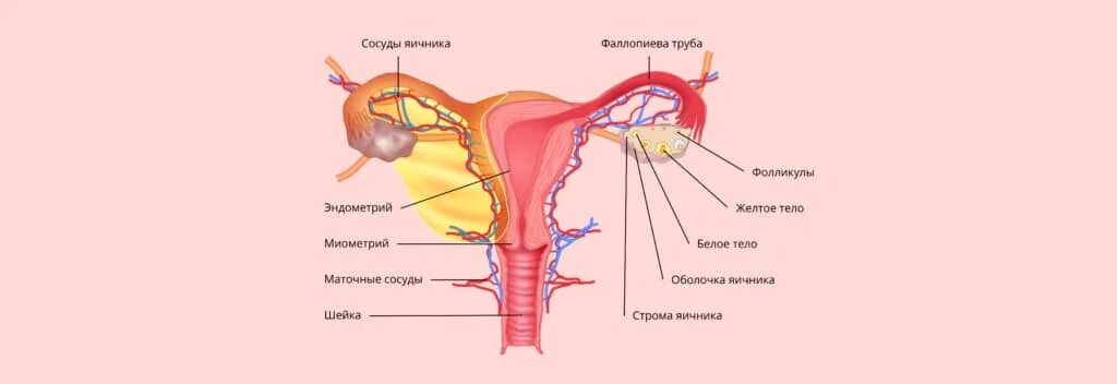 Маточное бесплодие