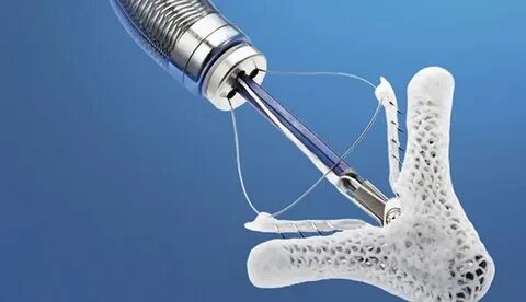 Globalroot device