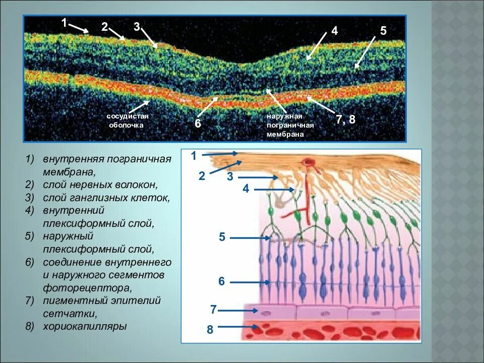Внутренняя глиальная Пограничная мембрана сетчатки глаза. Внутренний плексиформный слой. Наружный плексиформный слой. Наружные слои сетчатки. Внутренним слоем и поверхностью