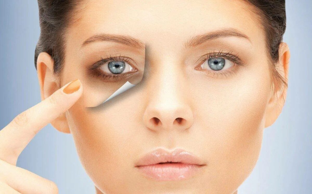 черные круги причины у женщин. тёмные круги под глазами причины. круги под глазами причины. черные круги причины у женщин. темные круги од глаазми.