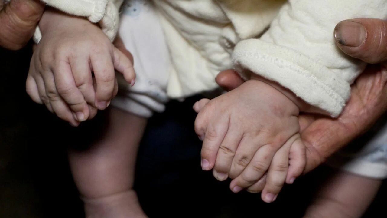 6 пальцев на руках у детей. Дети с шестью пальцами. Новорожденный на руках.