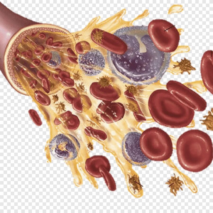 Склеивание крови. Эритроциты лейкоциты тромбоциты. Лейкоциты и тромбоциты в плазме крови. Клетки крови эритроциты лейкоциты тромбоциты. Плазма эритроциты лейкоциты тромбоциты.