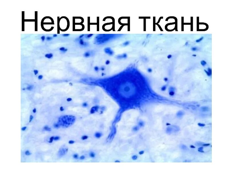 Тигроид гистология. Окраска по нисслю гистология. тигроид метиленовый синий. базофильное вещество окраска по нисслю.