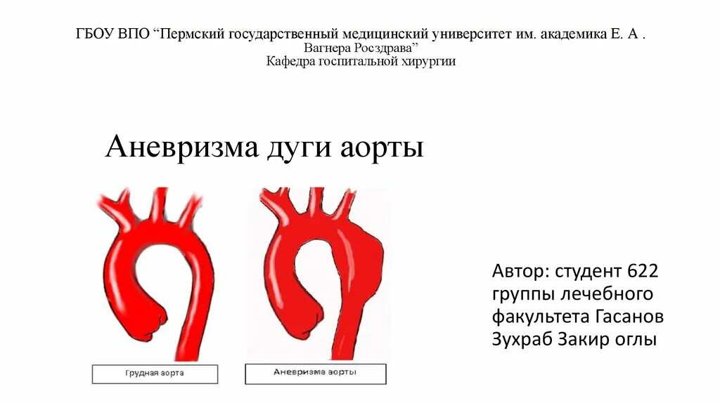 Восходящий отдел аорты норма. Инфраренальный отдел аорты норма. Грудной отдел аорты норма. Нормальный диаметр восходящего отдела аорты. Аневризма восходящей аорты операция