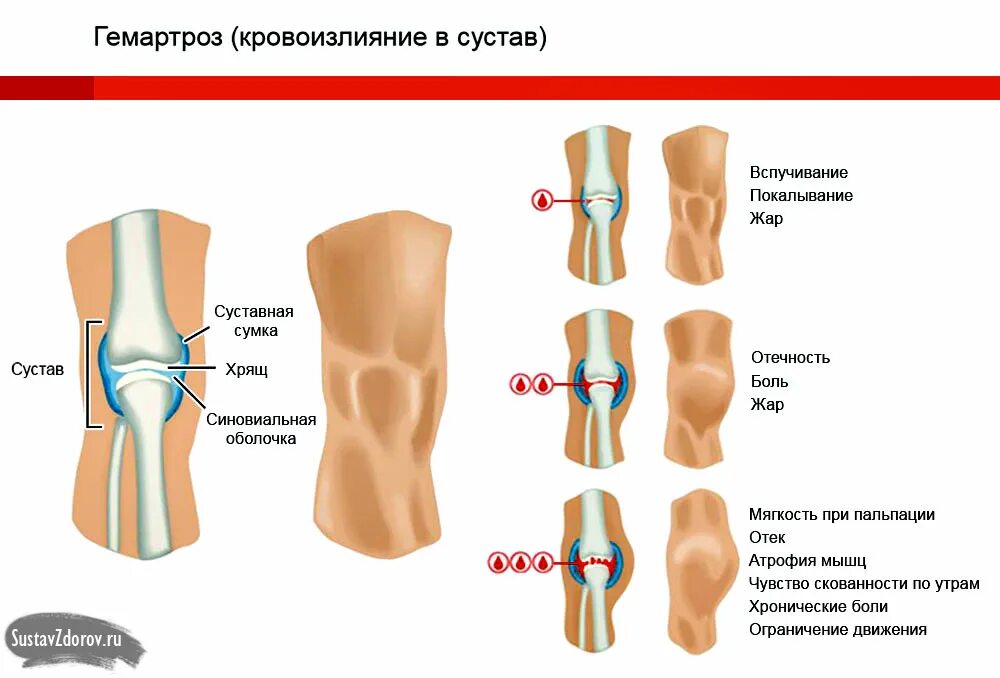 Неприятные ощущения в колене