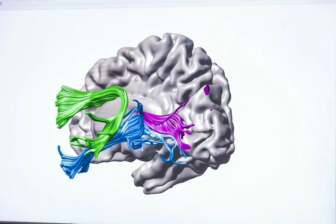 Brain 172. Гибкий мозг. Мозг картинка для детей. Гибкий мозг иллюстрация.