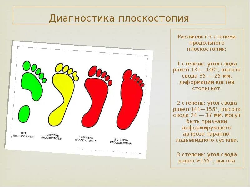 Средняя стопа. Стопа плоскостопие 2 степени. Показатели третьей степени плоскостопия. Лечится ли плоскостопие 1 степени у взрослых. Плоскостопие 3 степени вид сбоку.