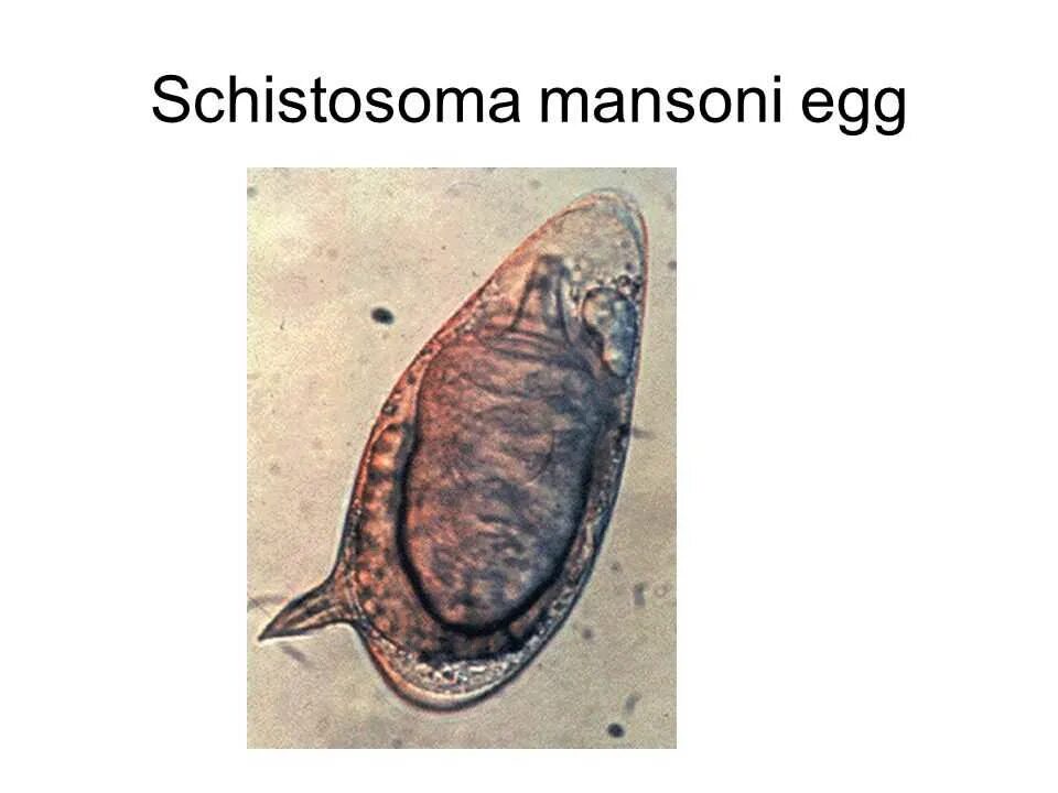 Кровяной сосальщик шистосома. Schistosoma mansoni яйца. Шистосома Мансона s. mansoni. Шистосома Мансона (Schistosoma mansoni. Кишечный сосальщик