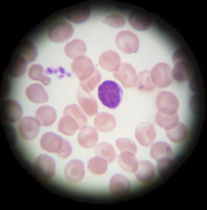 Т и б лимфоциты под микроскопом. Лимфоцит животные. B-клетки в b лимфоциты. Лимфоциты. Т лимфоциты под микроскопом.