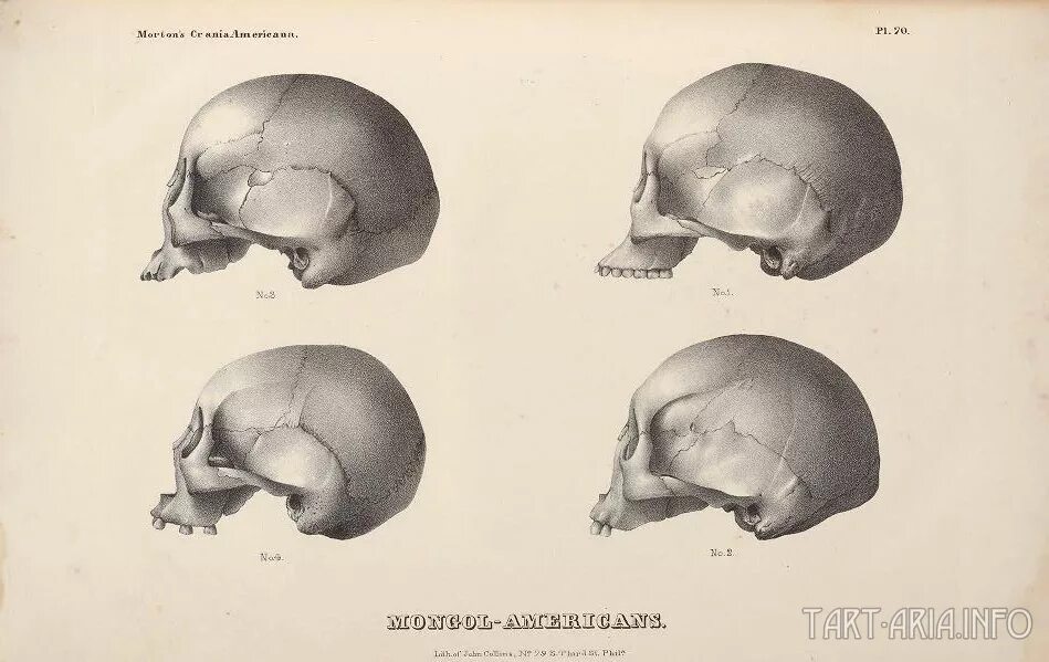 Варианты формы черепа. Форма черепа. Формы черепа человека. Правильная форма черепа.
