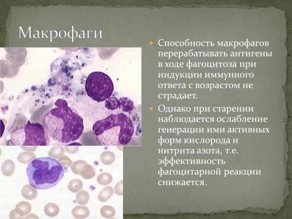 Макрофаги гистиоциты. Макрофаги в крови. Форма макрофагов. Подвижные макрофаги. Свободные макрофаги