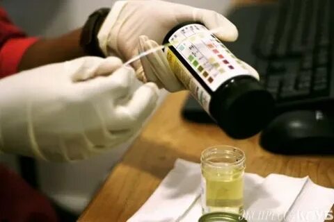 Исследование микроальбумина