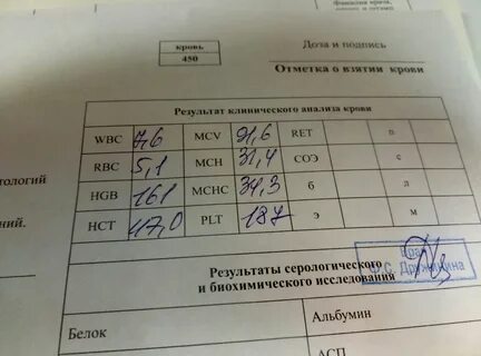Что значит анализ rw